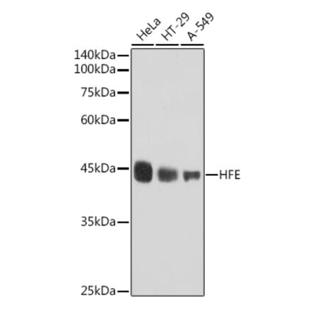 Western Blot - Anti-HFE Antibody [ARC2554] (A306374) - Antibodies.com