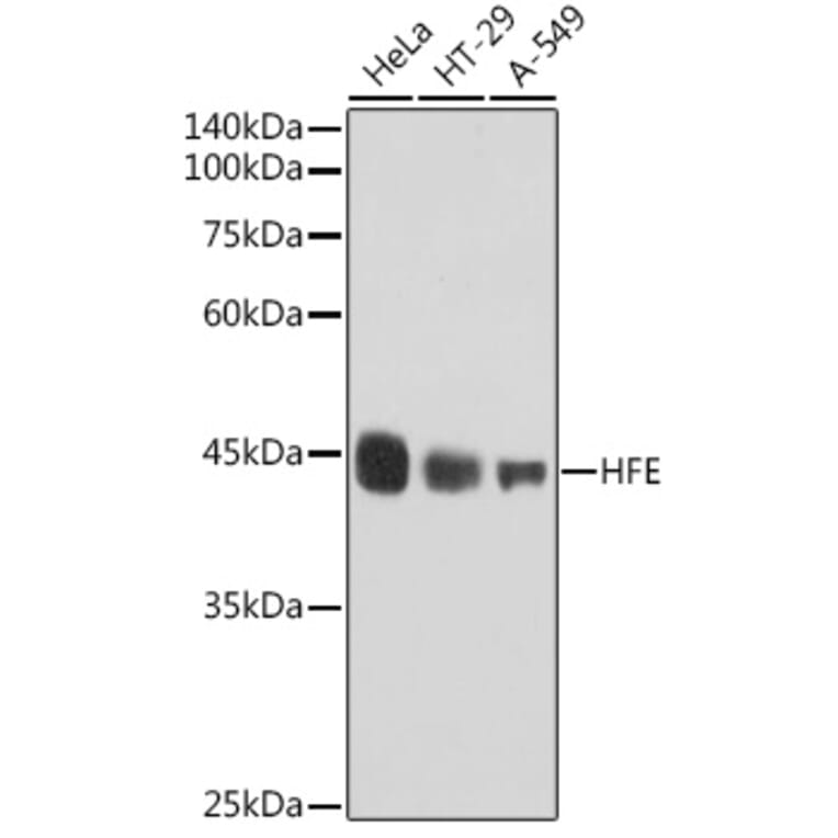 Western Blot - Anti-HFE Antibody [ARC2554] (A306374) - Antibodies.com