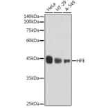 Western Blot - Anti-HFE Antibody [ARC2554] (A306374) - Antibodies.com