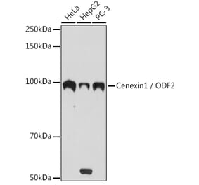Western Blot - Anti-Cenexin1/ODF2 Antibody [ARC2057] (A306375) - Antibodies.com