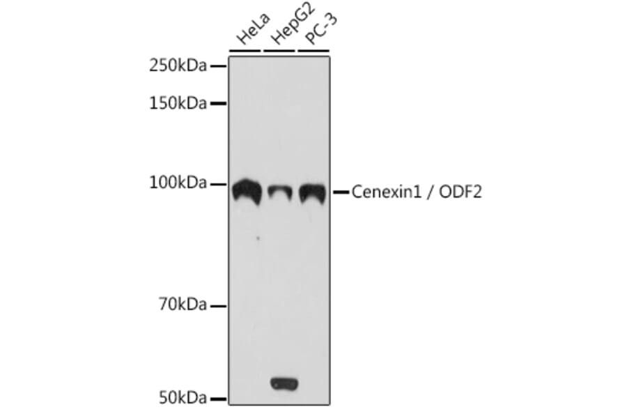 Western Blot - Anti-Cenexin1/ODF2 Antibody [ARC2057] (A306375) - Antibodies.com