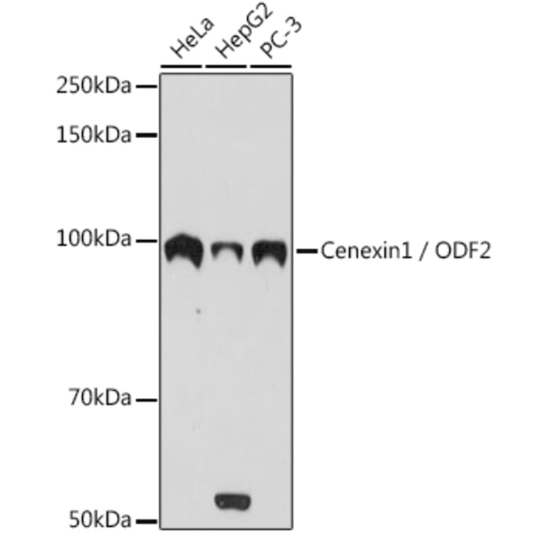 Western Blot - Anti-Cenexin1/ODF2 Antibody [ARC2057] (A306375) - Antibodies.com