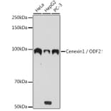 Western Blot - Anti-Cenexin1/ODF2 Antibody [ARC2057] (A306375) - Antibodies.com