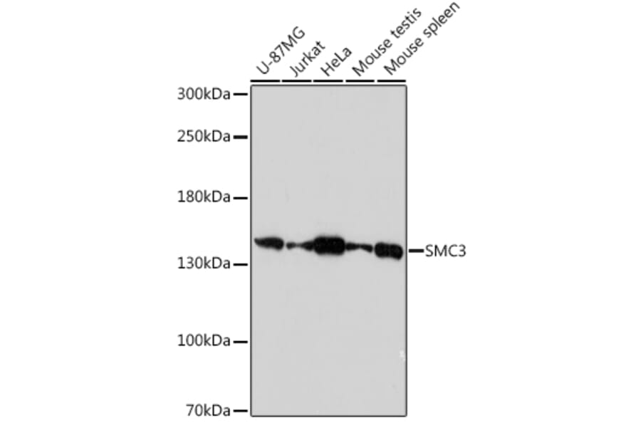Western Blot - Anti-SMC3 Antibody (A306376) - Antibodies.com