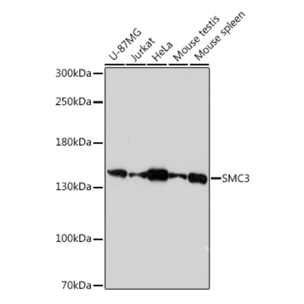 Western Blot - Anti-SMC3 Antibody (A306376) - Antibodies.com