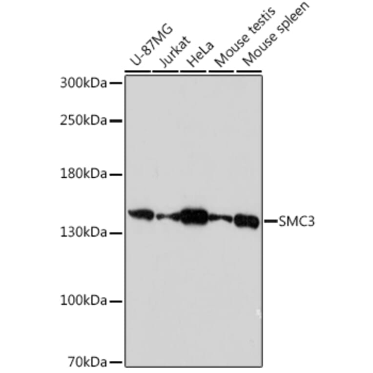 Western Blot - Anti-SMC3 Antibody (A306376) - Antibodies.com