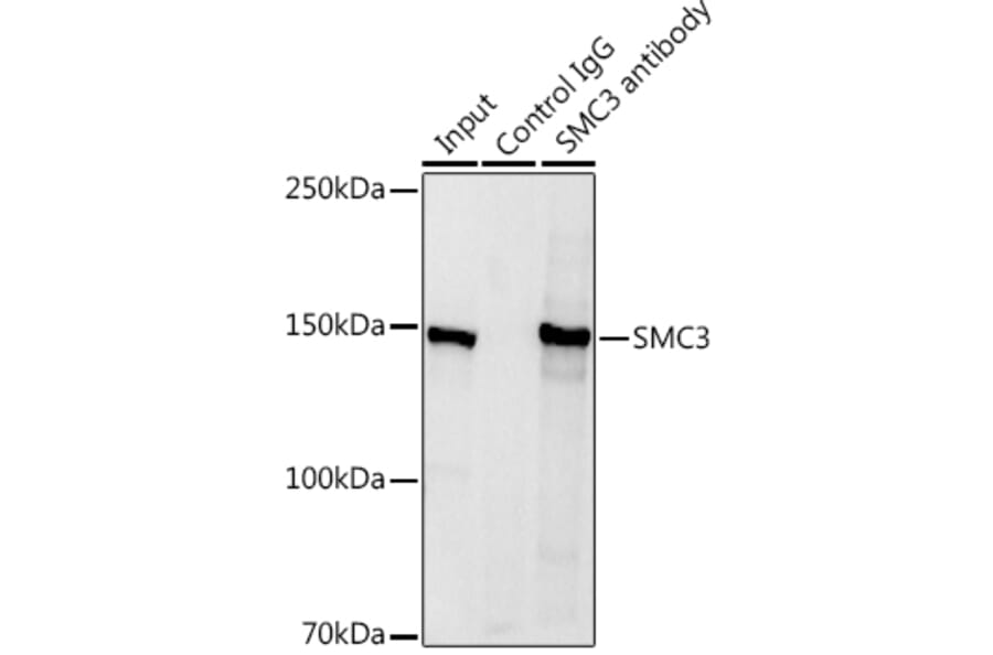 Western Blot - Anti-SMC3 Antibody (A306376) - Antibodies.com