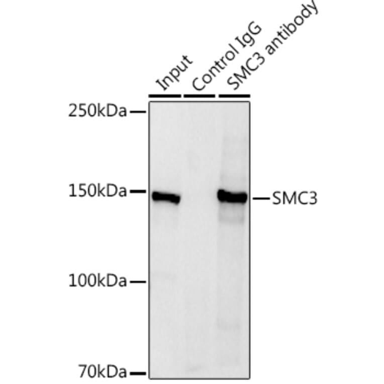 Western Blot - Anti-SMC3 Antibody (A306376) - Antibodies.com