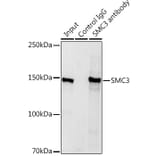 Western Blot - Anti-SMC3 Antibody (A306376) - Antibodies.com
