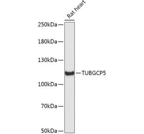 Western Blot - Anti-TUBGCP5 Antibody (A306377) - Antibodies.com