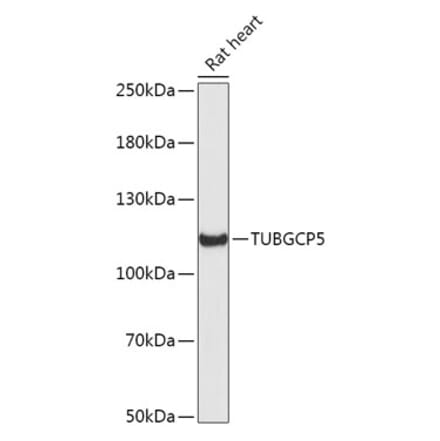 Western Blot - Anti-TUBGCP5 Antibody (A306377) - Antibodies.com