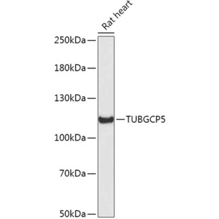 Western Blot - Anti-TUBGCP5 Antibody (A306377) - Antibodies.com