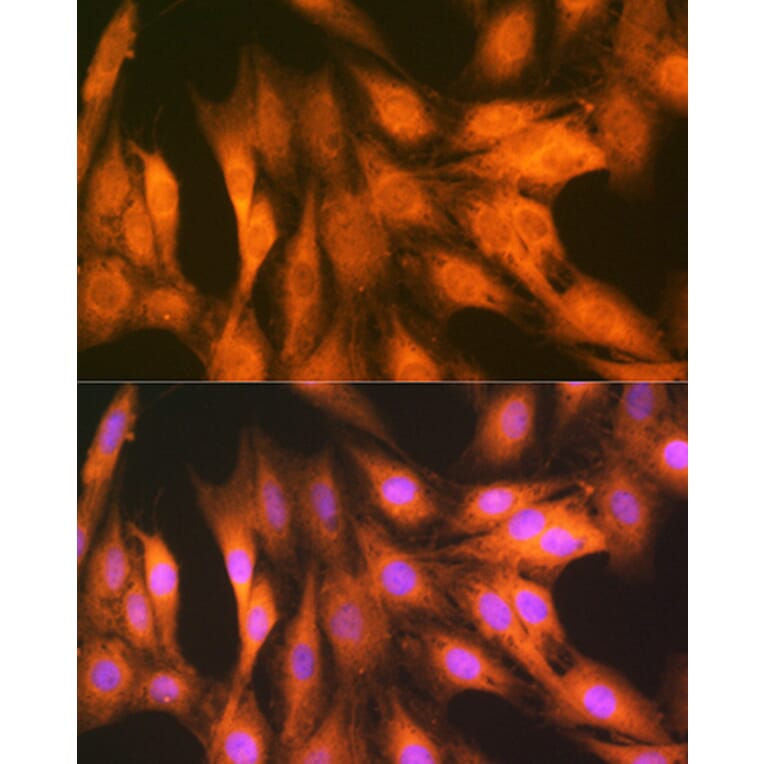 Immunofluorescence - Anti-FAT10 Antibody [ARC1379] (A306378) - Antibodies.com