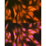 Immunofluorescence - Anti-FAT10 Antibody [ARC1379] (A306378) - Antibodies.com