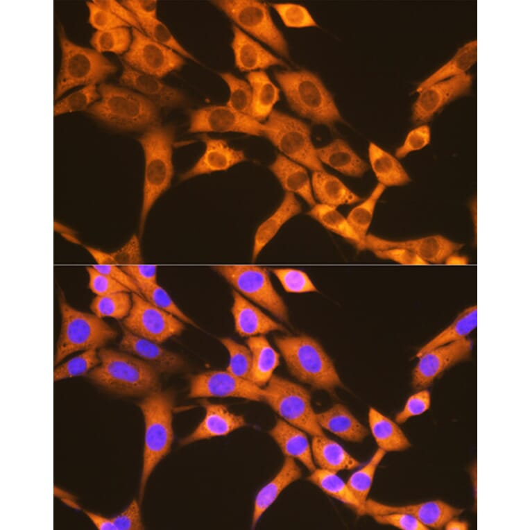 Immunofluorescence - Anti-FAT10 Antibody [ARC1379] (A306378) - Antibodies.com