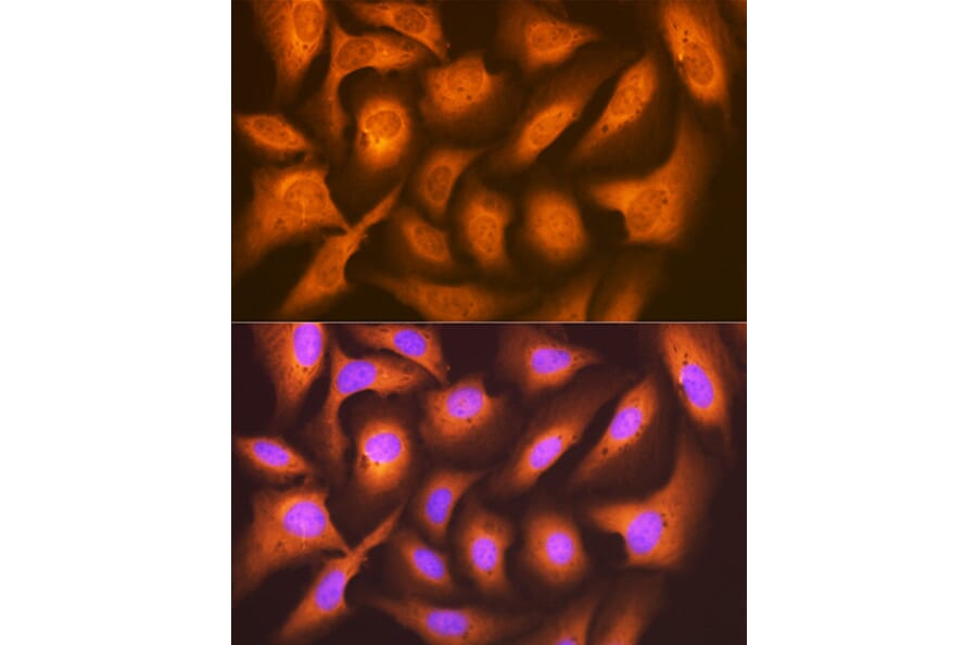 Immunofluorescence - Anti-FAT10 Antibody [ARC1379] (A306378) - Antibodies.com