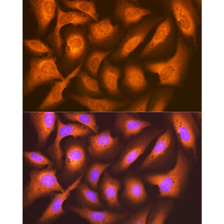 Immunofluorescence - Anti-FAT10 Antibody [ARC1379] (A306378) - Antibodies.com