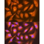 Immunofluorescence - Anti-FAT10 Antibody [ARC1379] (A306378) - Antibodies.com