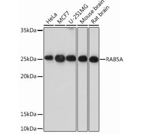 Western Blot - Anti-Rab5A Antibody [ARC0297] (A306380) - Antibodies.com