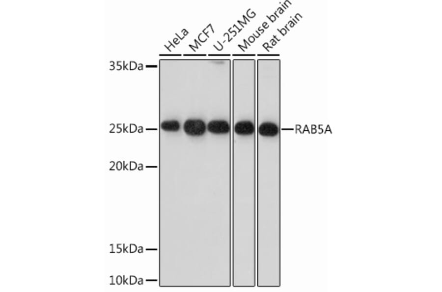 Western Blot - Anti-Rab5A Antibody [ARC0297] (A306380) - Antibodies.com