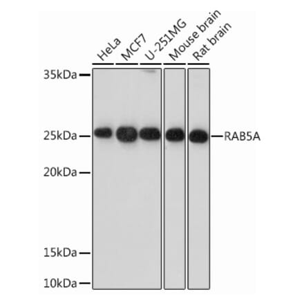 Western Blot - Anti-Rab5A Antibody [ARC0297] (A306380) - Antibodies.com