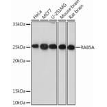 Western Blot - Anti-Rab5A Antibody [ARC0297] (A306380) - Antibodies.com