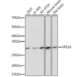 Western Blot - Anti-VPS24 Antibody [ARC1849] (A306381) - Antibodies.com