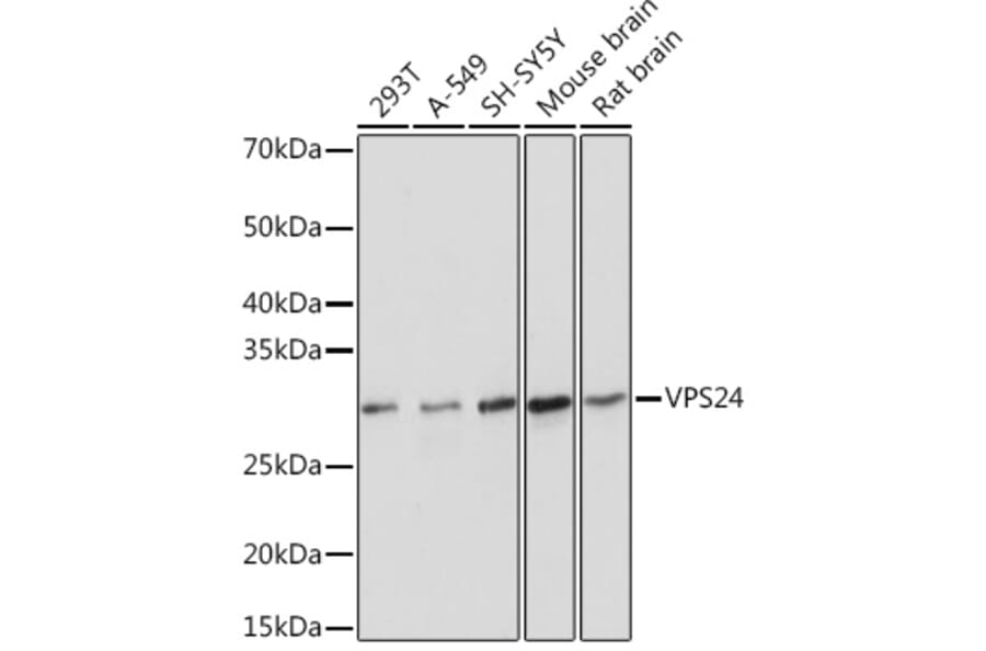 Western Blot - Anti-VPS24 Antibody [ARC1849] (A306381) - Antibodies.com