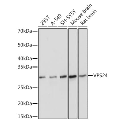 Western Blot - Anti-VPS24 Antibody [ARC1849] (A306381) - Antibodies.com