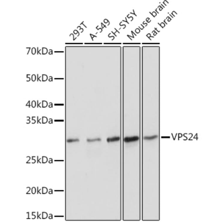 Western Blot - Anti-VPS24 Antibody [ARC1849] (A306381) - Antibodies.com