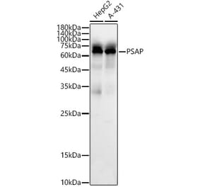 Western Blot - Anti-PSAP Antibody (A306382) - Antibodies.com
