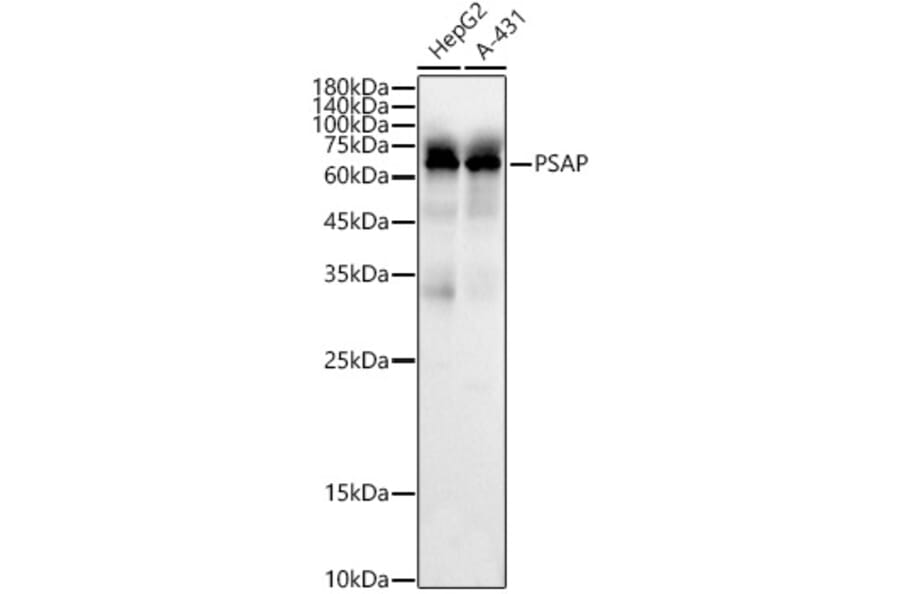 Western Blot - Anti-PSAP Antibody (A306382) - Antibodies.com