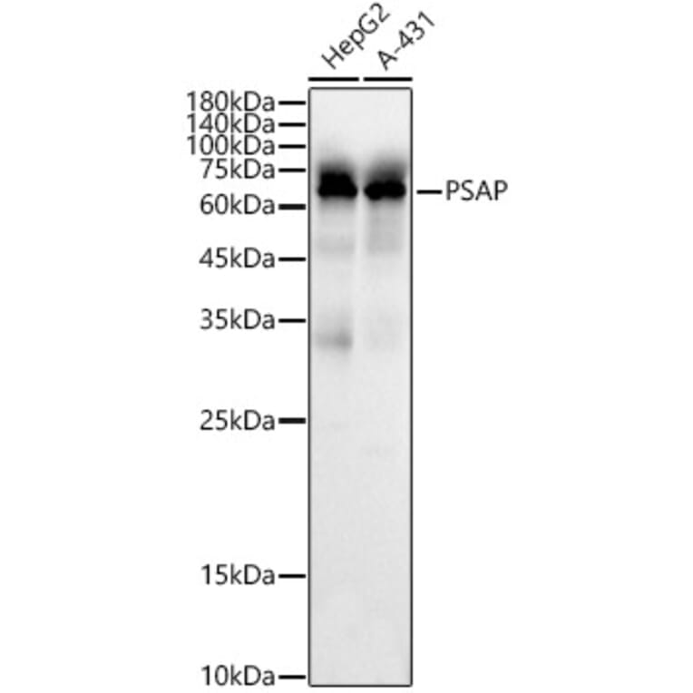 Western Blot - Anti-PSAP Antibody (A306382) - Antibodies.com