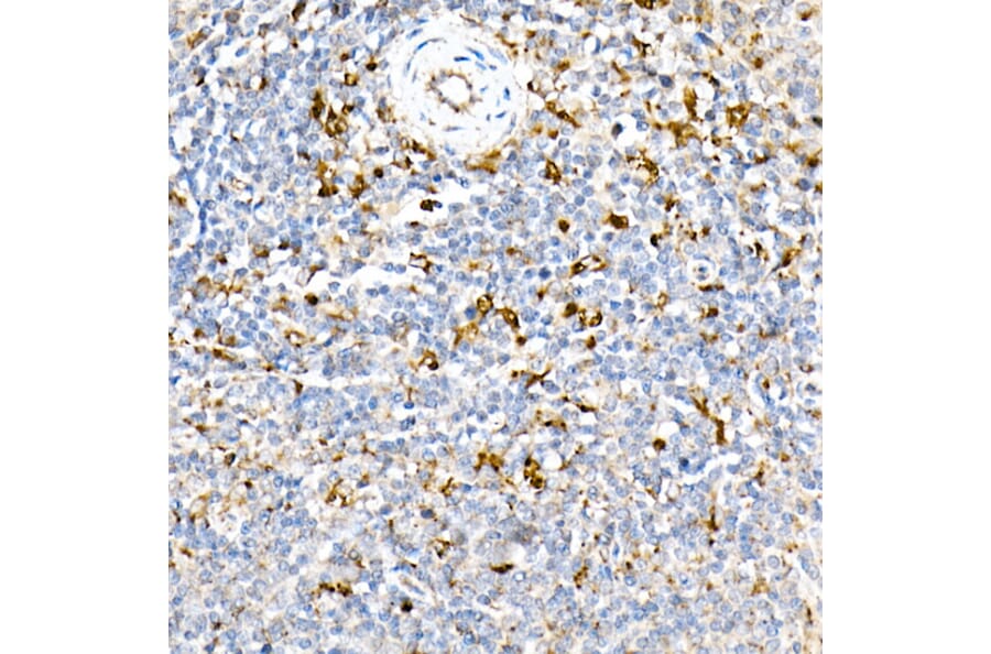 Immunohistochemistry - Anti-PSAP Antibody (A306382) - Antibodies.com