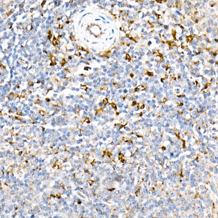 Immunohistochemistry - Anti-PSAP Antibody (A306382) - Antibodies.com