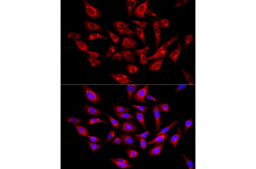 Immunofluorescence - Anti-PSAP Antibody (A306382) - Antibodies.com