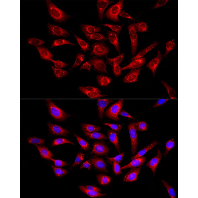 Immunofluorescence - Anti-PSAP Antibody (A306382) - Antibodies.com