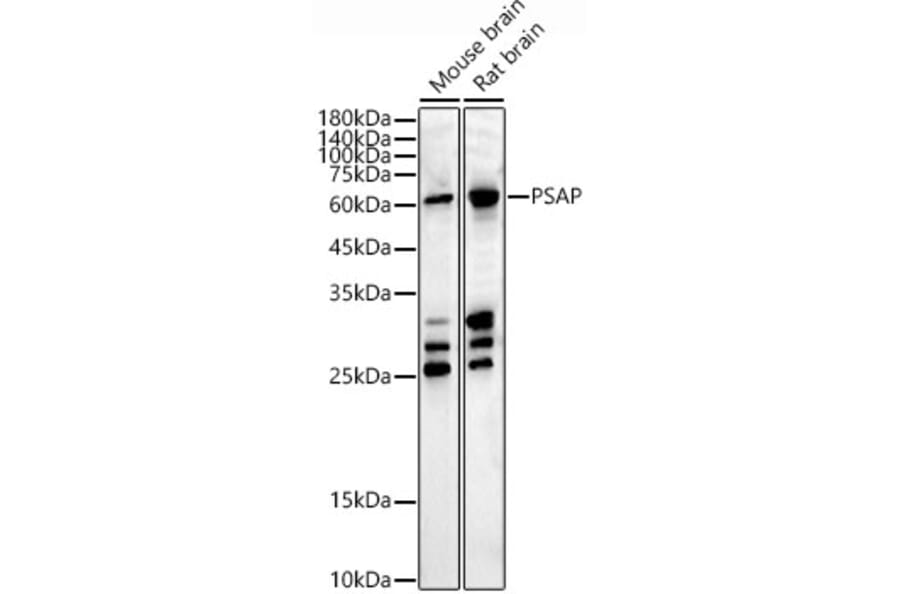Western Blot - Anti-PSAP Antibody (A306382) - Antibodies.com
