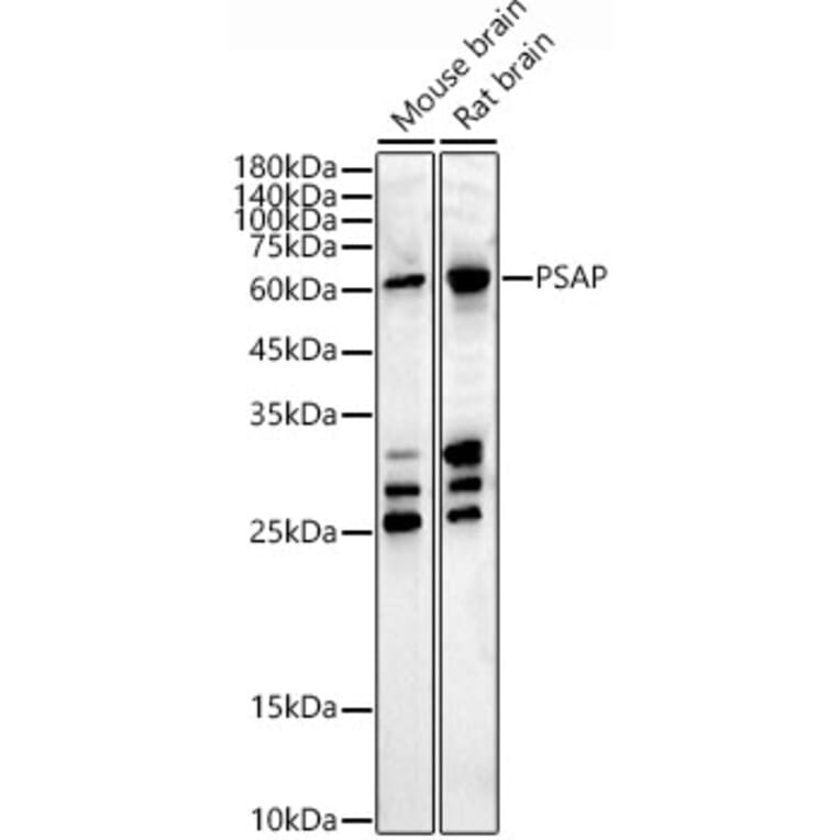 Western Blot - Anti-PSAP Antibody (A306382) - Antibodies.com