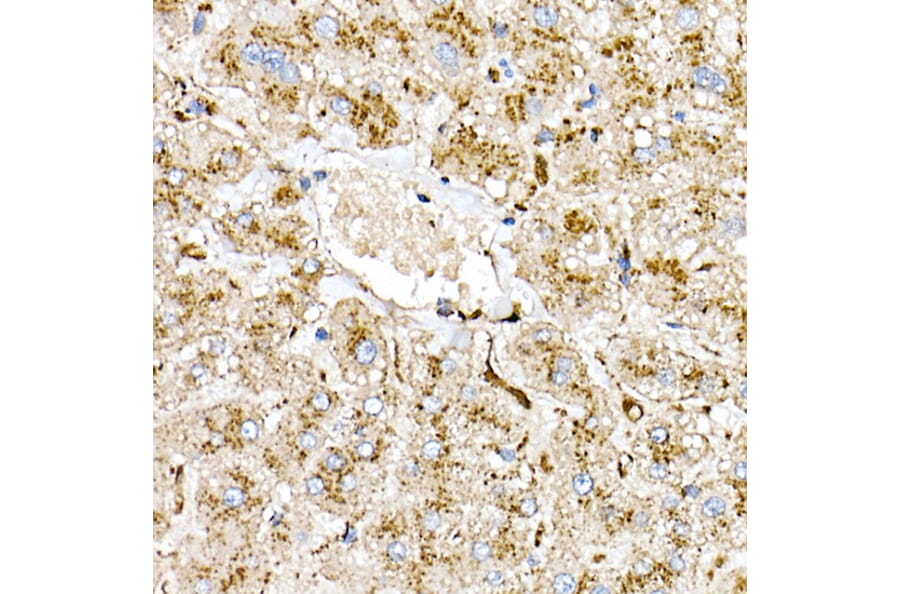 Immunohistochemistry - Anti-PSAP Antibody (A306382) - Antibodies.com