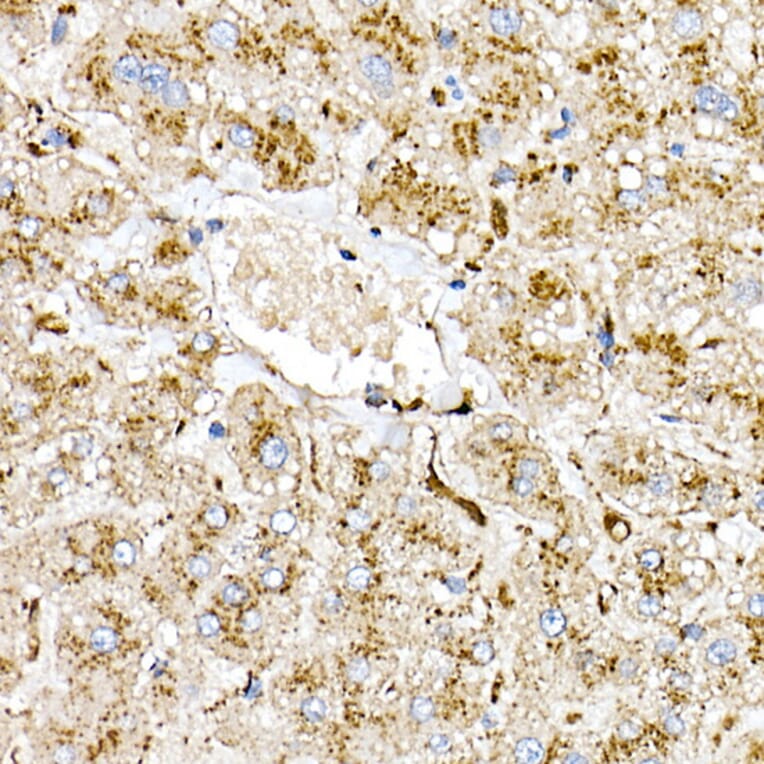 Immunohistochemistry - Anti-PSAP Antibody (A306382) - Antibodies.com