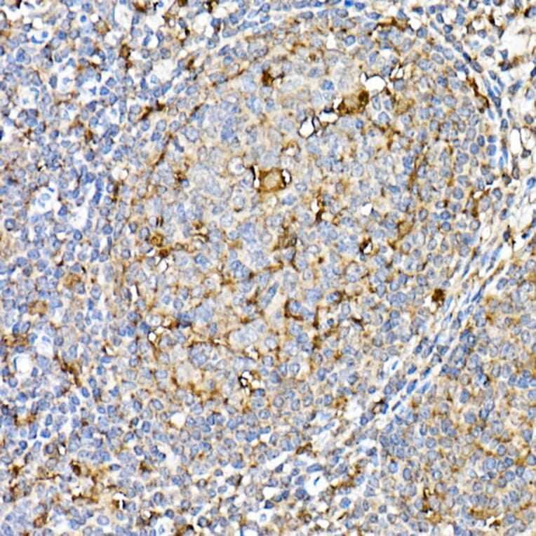 Immunohistochemistry - Anti-PSAP Antibody (A306382) - Antibodies.com