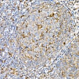 Immunohistochemistry - Anti-PSAP Antibody (A306382) - Antibodies.com