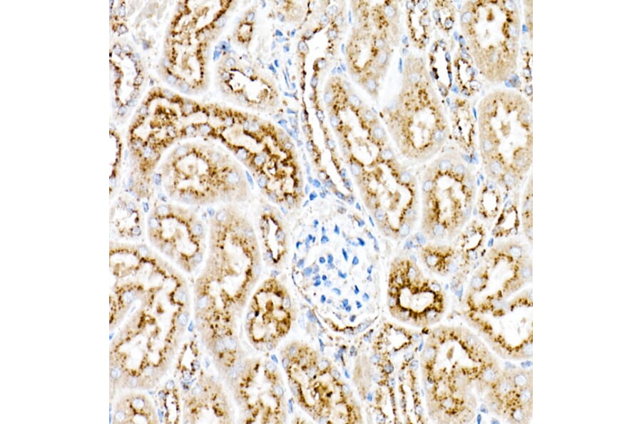 Immunohistochemistry - Anti-PSAP Antibody (A306382) - Antibodies.com