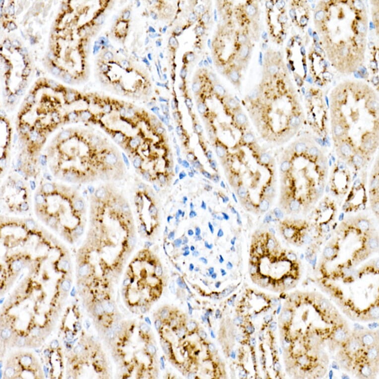 Immunohistochemistry - Anti-PSAP Antibody (A306382) - Antibodies.com