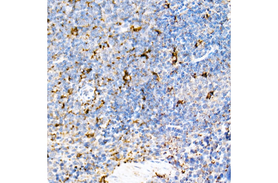 Immunohistochemistry - Anti-PSAP Antibody (A306382) - Antibodies.com