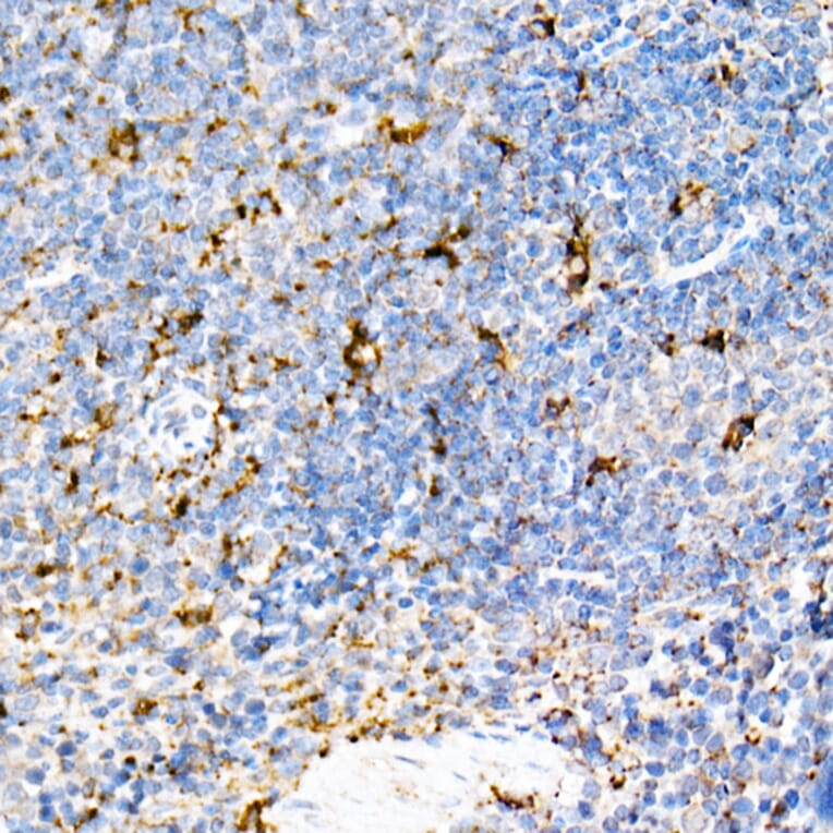 Immunohistochemistry - Anti-PSAP Antibody (A306382) - Antibodies.com