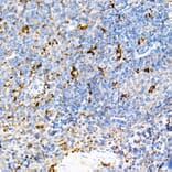 Immunohistochemistry - Anti-PSAP Antibody (A306382) - Antibodies.com