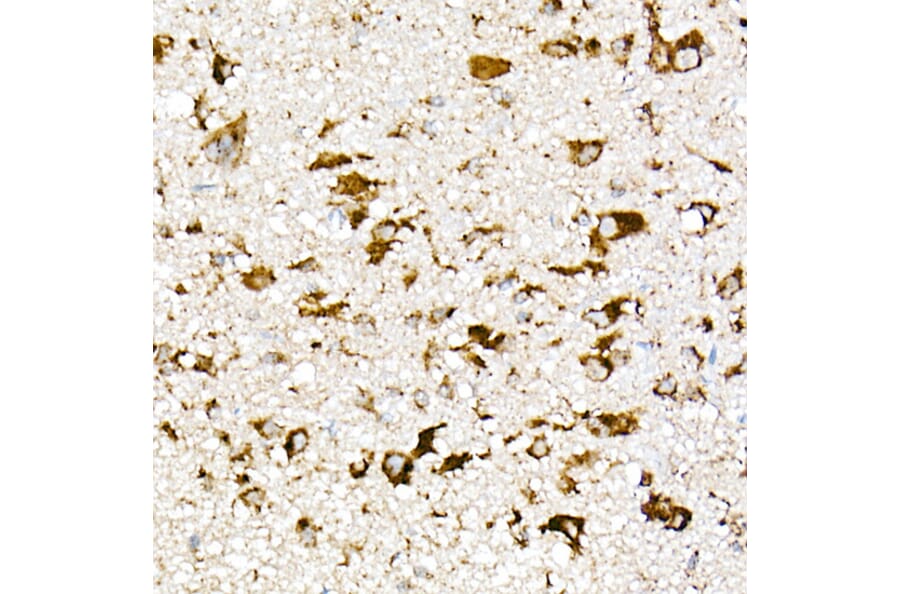 Immunohistochemistry - Anti-PSAP Antibody (A306382) - Antibodies.com