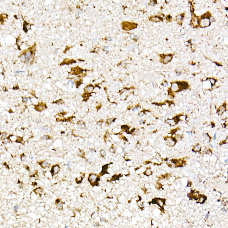 Immunohistochemistry - Anti-PSAP Antibody (A306382) - Antibodies.com